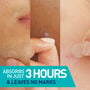 CeraVe&reg; Blemish Barrier Patches, 22 ct., , large image number 4
